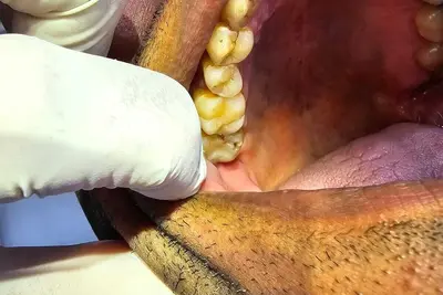 Image de Imbassai, Residencial Ykutiba Resort, beachfront paradise